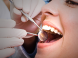 Безболезненное лечение зубов в наше время